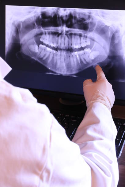 Best Dental Abscess Treatment in Grimes, IA